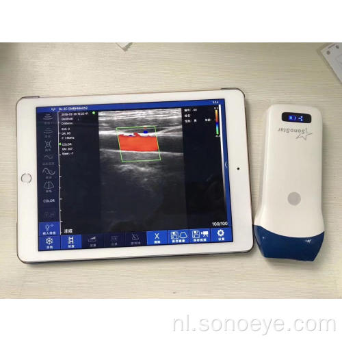 Handheld draadloze echografie voor telefoon en pad